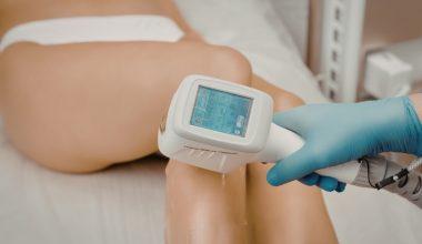 curs epilare defintiiva pret